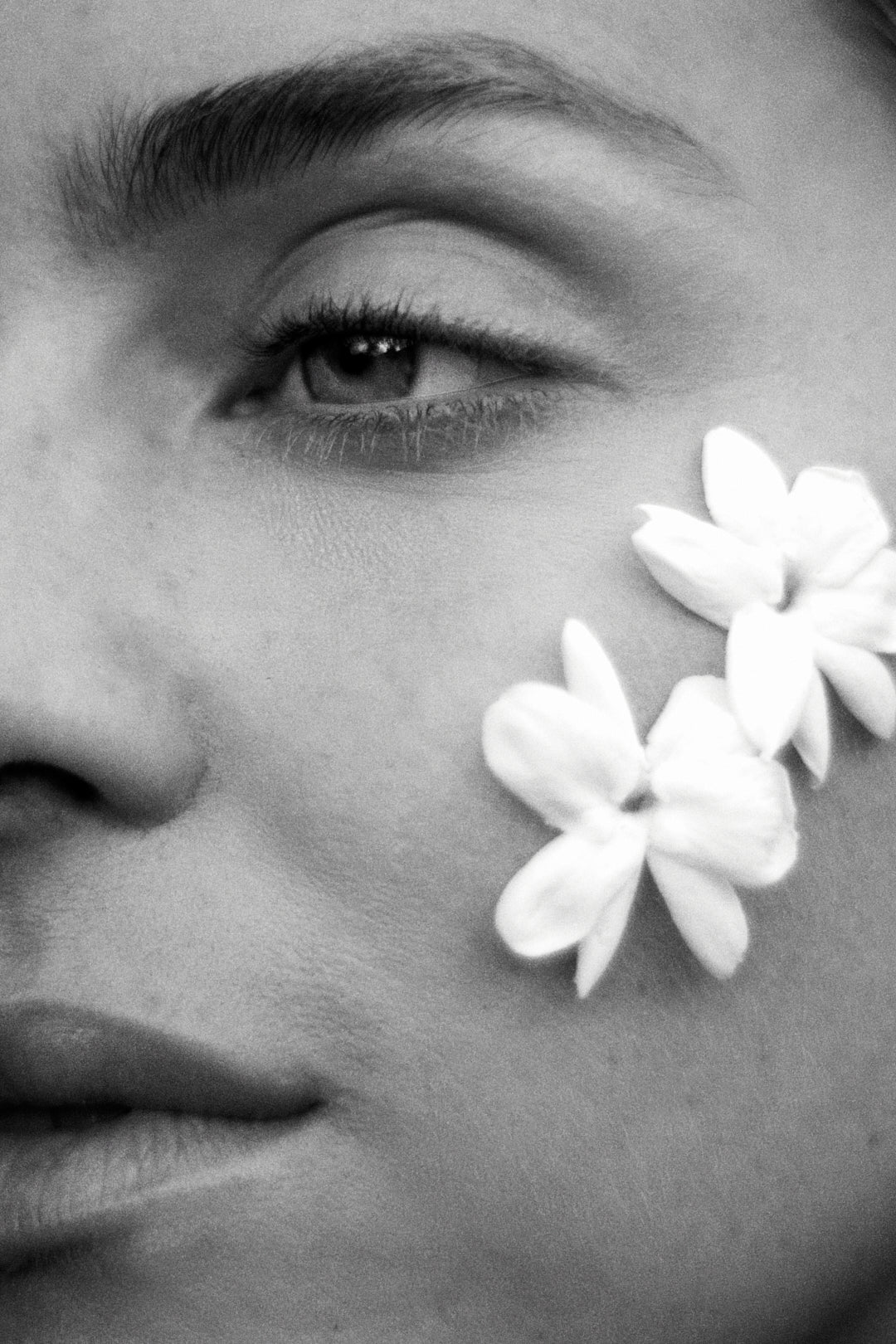 MICRO-NEEDLING TREATMENT